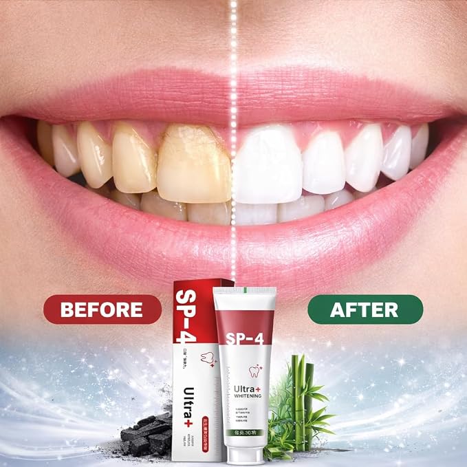 🦷 SP-4 Probiotic Whitening Toothpaste | Deep Clean, Fresh Breath & Brighter Smile